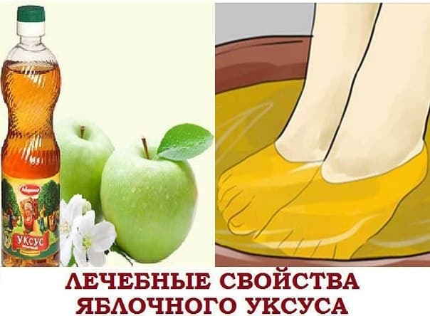 Яблочный уксус при варикозе на ногах: как пользоваться, отзывы, рецепты