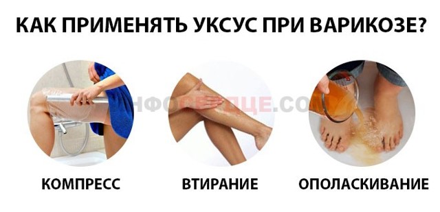 Яблочный уксус при варикозе на ногах: как пользоваться, отзывы, рецепты
