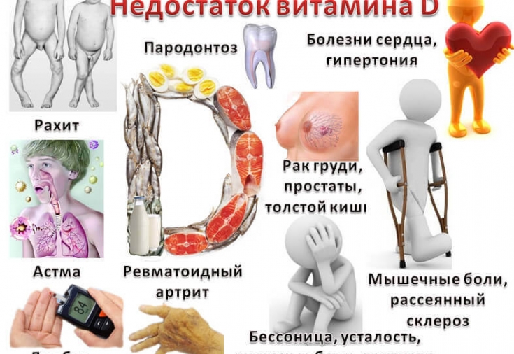 Как восполнить витамин д в организме