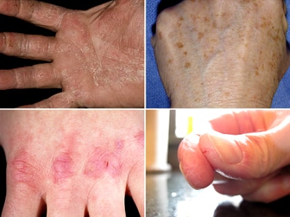 Какие витамины пить при авитаминозе