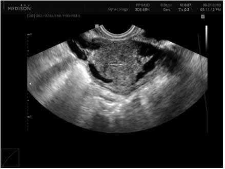 Какой врач лечит варикоз: флеболог, хирург, ангиолог, терапевт