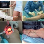 Какой врач лечит варикоз: флеболог, хирург, ангиолог, терапевт