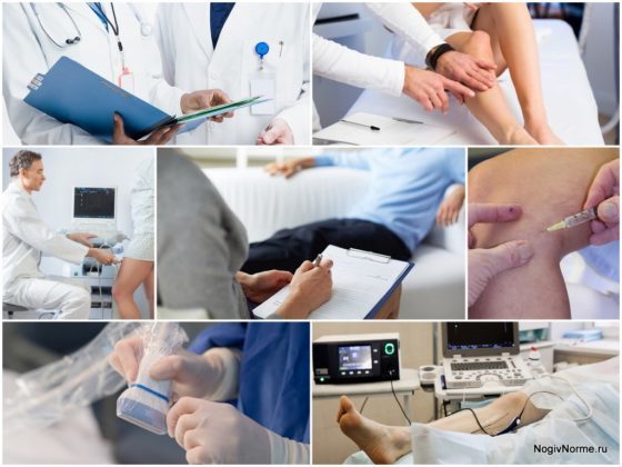 Какой врач лечит варикоз: флеболог, хирург, ангиолог, терапевт