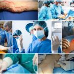 Какой врач лечит варикоз: флеболог, хирург, ангиолог, терапевт