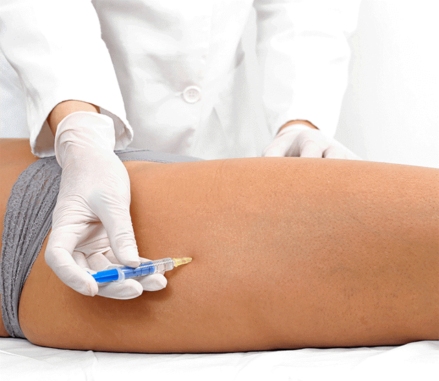 Какой врач лечит варикоз: флеболог, хирург, ангиолог, терапевт