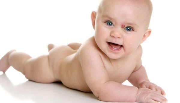 Капиллярная гемангиома у взрослых и новорожденных детей: фото, лечение, виды