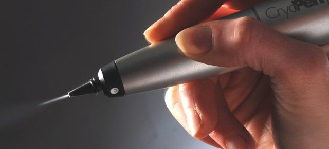 Капиллярная гемангиома у взрослых и новорожденных детей: фото, лечение, виды