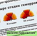 Компресс новокаин и диклофенак – можно ли принимать одновременно (совместимость)