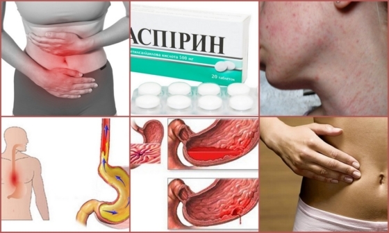 Кроверазжижающие препараты при варикозе и тромбозе нового поколения без аспирина: как принимать, показания, противопоказания