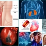 Кроверазжижающие препараты при варикозе и тромбозе нового поколения без аспирина: как принимать, показания, противопоказания