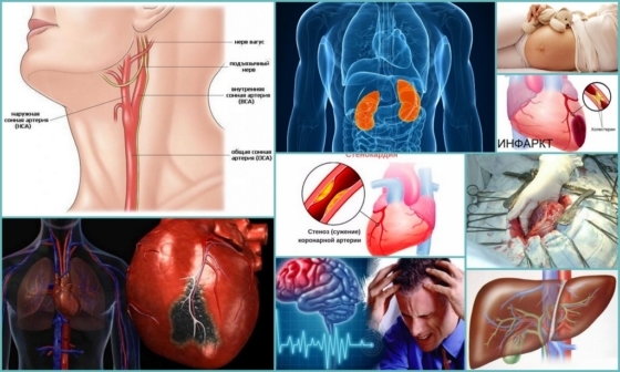 Кроверазжижающие препараты при варикозе и тромбозе нового поколения без аспирина: как принимать, показания, противопоказания