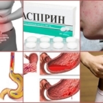 Кроверазжижающие препараты при варикозе и тромбозе нового поколения без аспирина: как принимать, показания, противопоказания