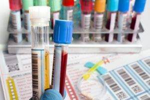 Кто такой флеболог (сосудистый хирург): какие паталогии лечит, как выбрать хорошего специалиста