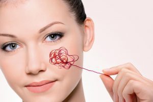 Купероз на лице: лечение (препараты), причины, симптомы