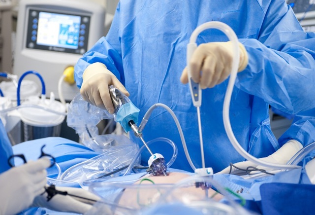 Лапароскопия варикоцеле: как делается, восстановление после операции, отзывы, цена