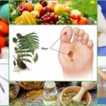 Лечение трофических язв в домашних условиях