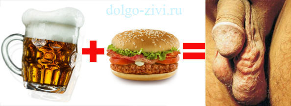 Лечение варикоцеле без операции: таблетки, народные средства, отзывы мужчин