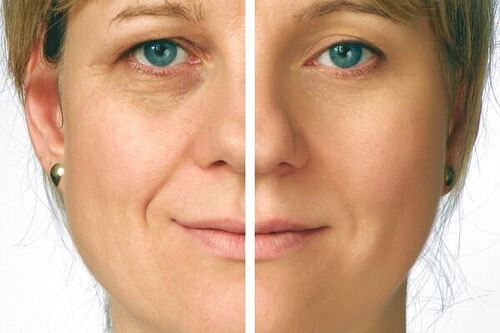 Лимфодренаж лица: как делать в домашних условиях, что это такое, видео