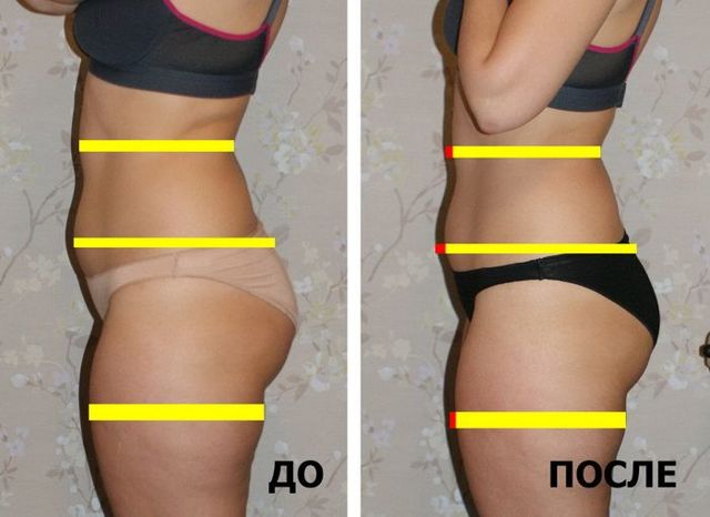 Лимфодренаж в домашних условиях (щеткой, аппаратный, ручной) – показания и противопоказания для массажа рук, ног, лица