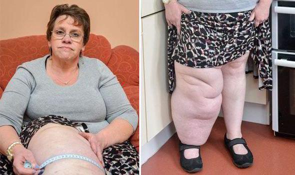 Лимфостаз руки: лечение (диеты, народные методы), причины, диагностика