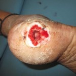 Лиотон и венолайф: что лучше и в чем разница (отличие составов, отзывы врачей)