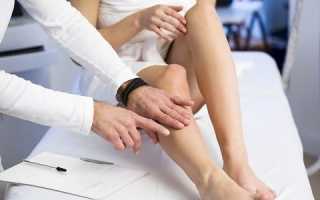 Начальная стадия варикоза на ногах: способы лечения и как распознать (симптомы, диагностика)