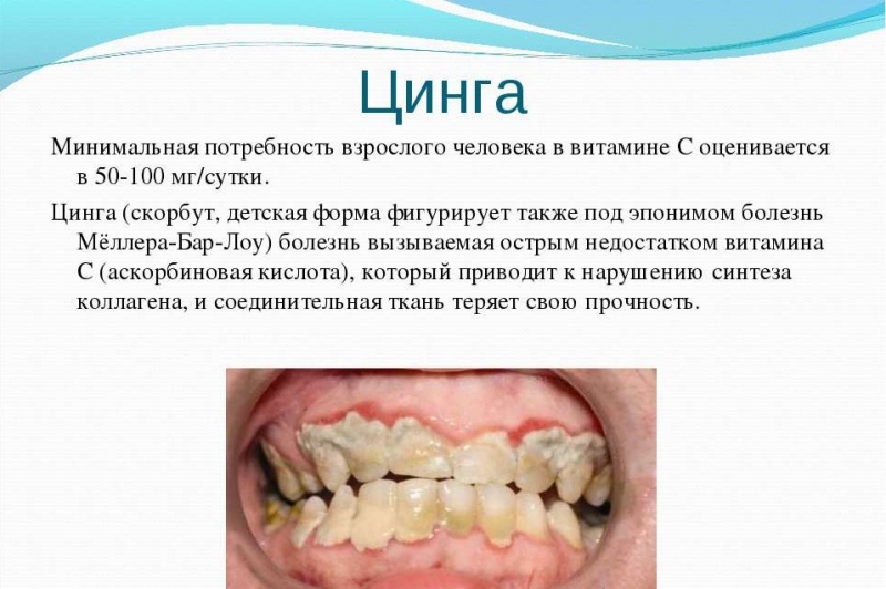 Нехватка витамина а симптомы у взрослых