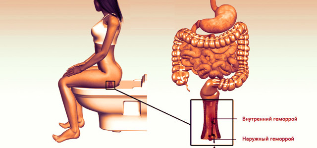Неовен и венарус: что лучше и в чем разница (отличие составов, отзывы врачей)
