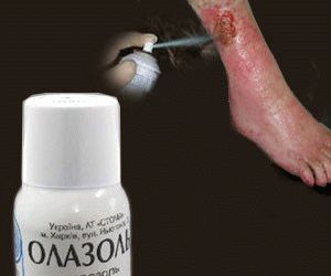 Обезболивающие при трофических язвах