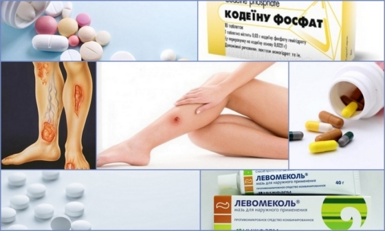 Обезболивающие при трофических язвах