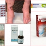 Обезболивающие при трофических язвах