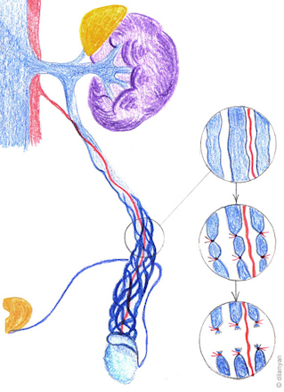 Операция мармара при варикоцеле: показания и противопоказания, преимущества и недостатки, техника проведения, осложнения, стоимость