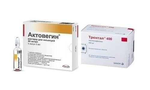 Пентоксифиллин и актовегин: что лучше и в чем разница (отличие составов, отзывы врачей)