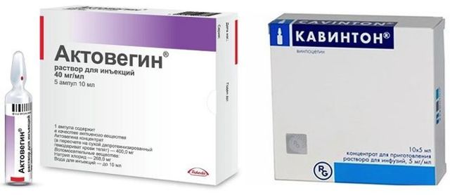 Пентоксифиллин и кавинтон: что лучше и в чем разница (отличие составов, отзывы врачей)