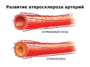 Пентоксифиллин и мексидол: что лучше и в чем разница (отличие составов, отзывы врачей)