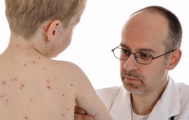 Передозировка аскорбиновой кислоты у ребенка