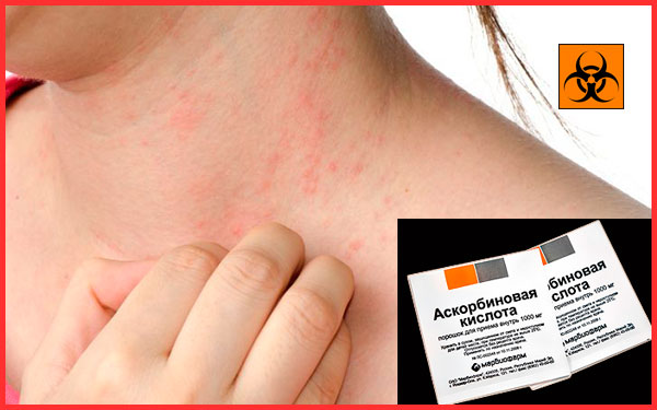 Передозировка аскорбиновой кислоты у ребенка