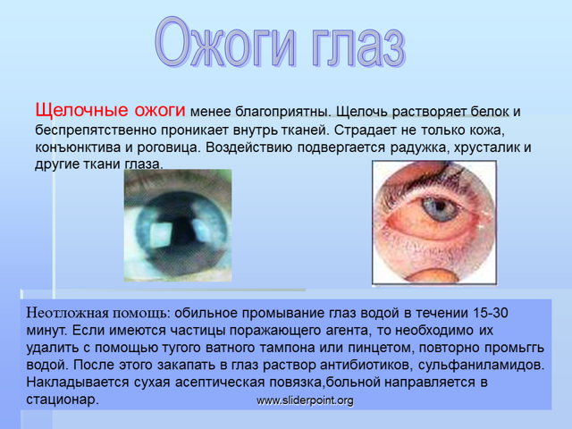 Последствия от перцового баллончика и первая помощь