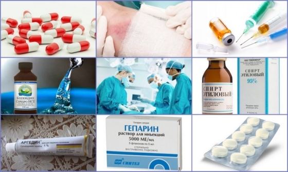 Постинъекционный флебит: лечение