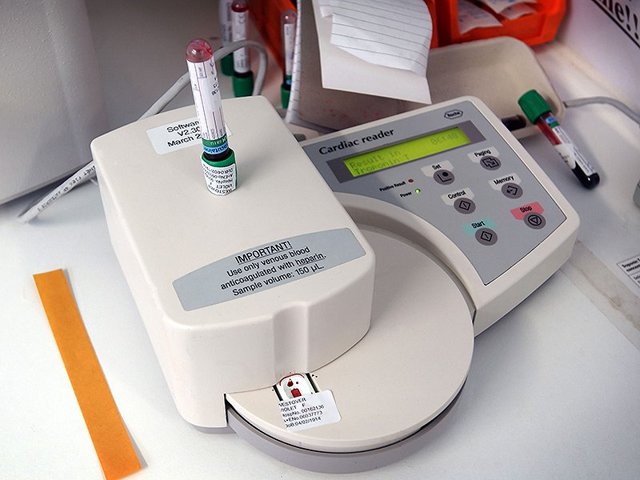 Постинъекционный флебит: лечение