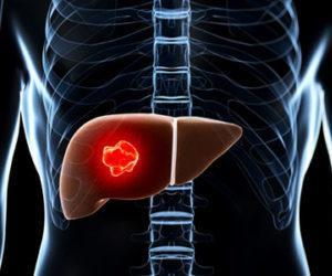 Причины гемангиомы у взрослых в печени, на позвоночнике, коже