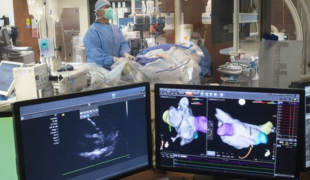 Радиочастотная абляция (рча) и внутривенная лазерная абляция (evla)