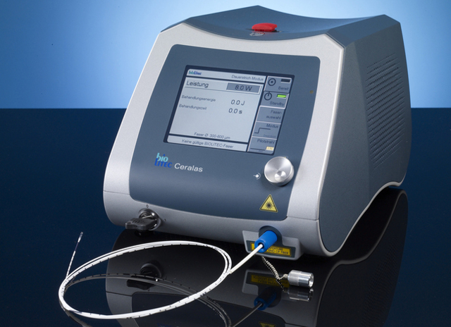 Радиочастотная абляция (рча) и внутривенная лазерная абляция (evla)