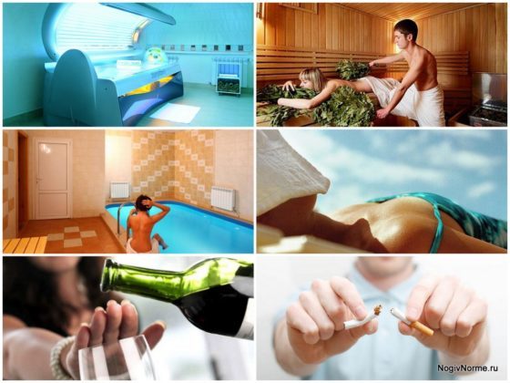 Реабилитация после операции на варикоз нижних конечностей: что можно и нельзя делать после операции, стационарное и домашнее восстановление