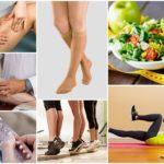 Реабилитация после операции на варикоз нижних конечностей: что можно и нельзя делать после операции, стационарное и домашнее восстановление