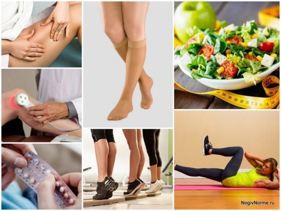 Реабилитация после операции на варикоз нижних конечностей: что можно и нельзя делать после операции, стационарное и домашнее восстановление