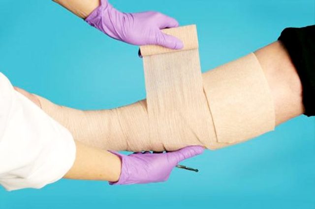 Реабилитация после операции на варикоз нижних конечностей: что можно и нельзя делать после операции, стационарное и домашнее восстановление