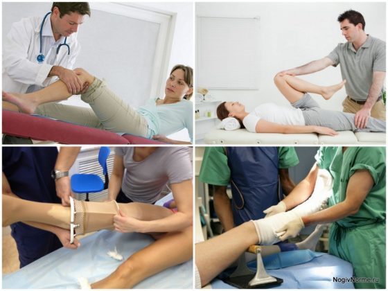 Реабилитация после операции на варикоз нижних конечностей: что можно и нельзя делать после операции, стационарное и домашнее восстановление