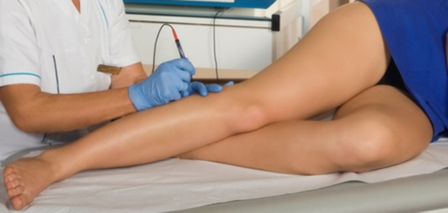 Реабилитация после операции на варикоз нижних конечностей: что можно и нельзя делать после операции, стационарное и домашнее восстановление