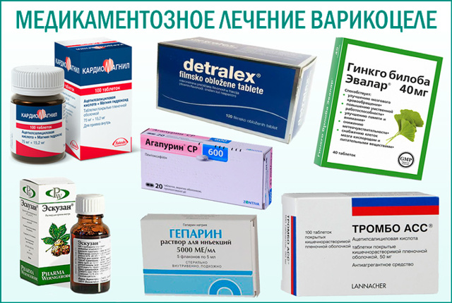 Рецидив варикоцеле после операции: признаки, причины, лечение, профилактика